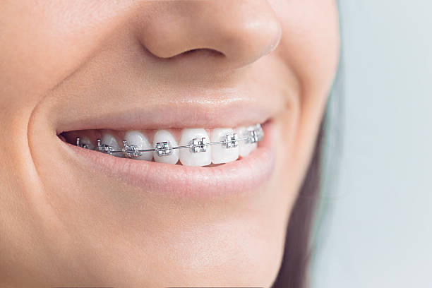 Best Teeth Whitening  in Crane, MO